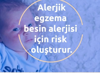 Alerjik egzema besin alerjisi için risk oluşturur.